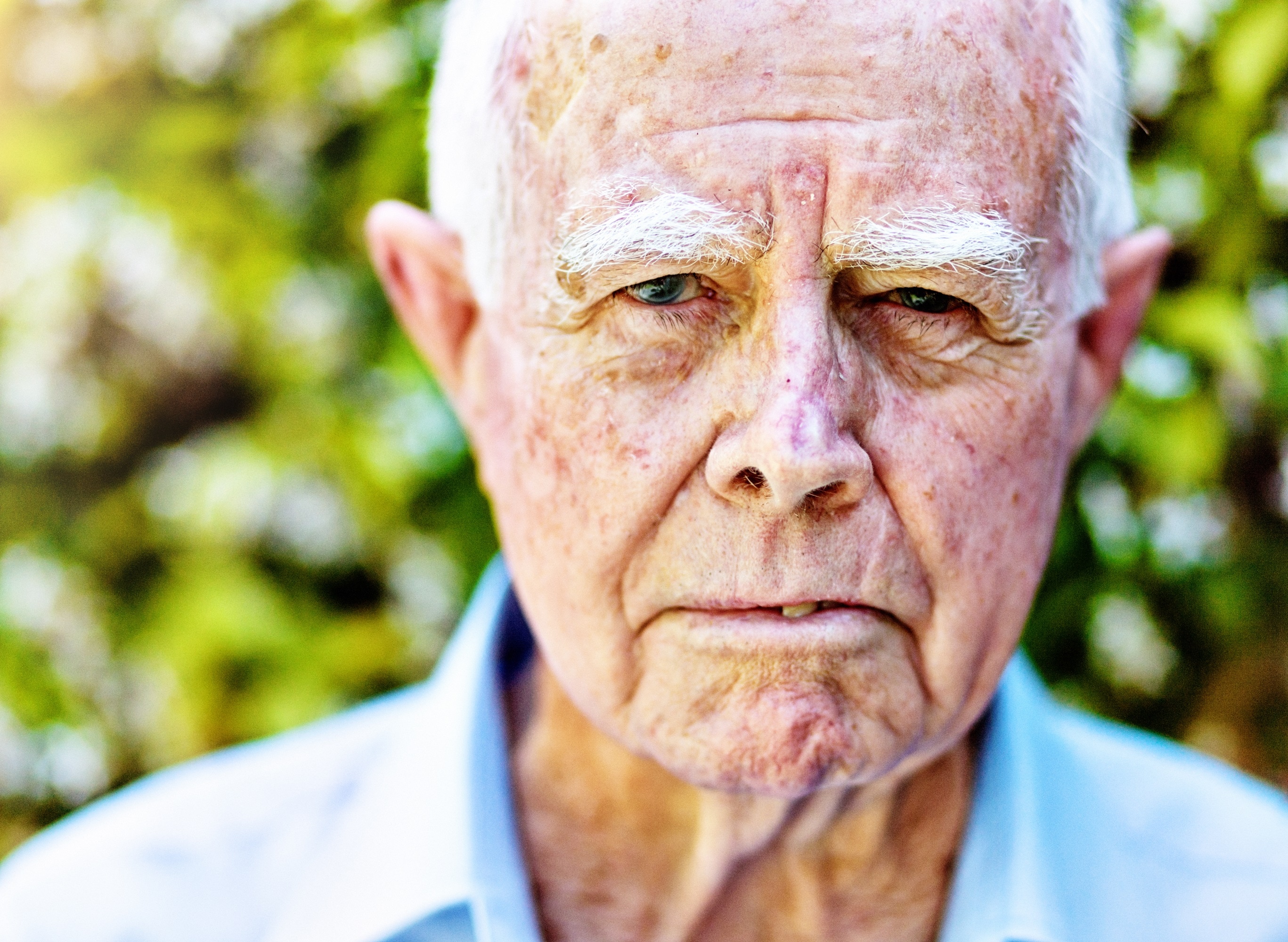 Ältere Männer sind besonders häufig von Hautkrebs betroffen.